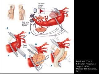 Brunicardi FC et al.
Schwartz’s Principles of
Surgery. 10th ed.
McGraw-Hill Education,
2015.
 