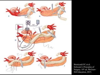 Brunicardi FC et al.
Schwartz’s Principles of
Surgery. 10th ed. McGraw-
Hill Education, 2015.
 