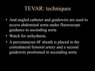 TEVAR: techniques
• And angled catheter and guidewire are used to
access abdominal aorta under fluoroscope
guidance to ascending aorta
• Watch for arrhythmia
• A percutaneous 6F sheath is placed in the
contralateral femoral artery and a second
guidewire positioned in ascending aorta
 