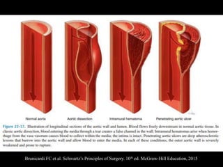 Brunicardi FC et al. Schwartz’s Principles of Surgery. 10th ed. McGraw-Hill Education, 2015
 