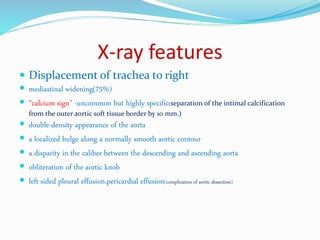 X-ray features
 Displacement of trachea to right
 mediastinal widening(75%)
 “calcium sign” -uncommon but highly specific(separation of the intimal calcification
from the outer aortic soft tissue border by 10 mm.)
 double-density appearance of the aorta
 a localized bulge along a normally smooth aortic contour
 a disparity in the caliber between the descending and ascending aorta
 obliteration of the aortic knob
 left sided pleural effusion,pericardial effusion(complication of aortic dissection)
 