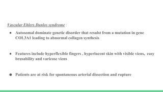 Vascular Ehlers Danlos syndrome :
● Autosomal dominate genetic disorder that resulst from a mutation in gene
COL3A1 leading to abnormal collagen synthesis
● Features include hyperflexible fingers , hyperlucent skin with visible viens, easy
brusability and varicose viens
● Patients are at risk for spontaneous arterial dissection and rupture
 