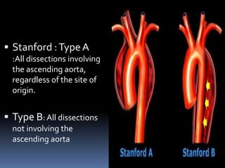 Aortic dissection 01 | PPTX