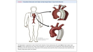 EMGuideWire's Radiology Reading Room: Aortic Dissection