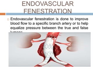 ENDOVASCULAR
FENESTRATION
 Endovascular fenestration is done to improve
blood flow to a specific branch artery or to help
equalize pressure between the true and false
lumens.
 