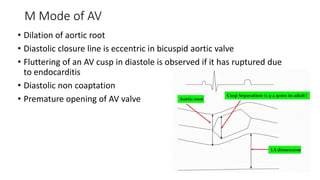 valvular heart diseaseAORTIC REGURGITATION.pptx