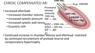 valvular heart diseaseAORTIC REGURGITATION.pptx