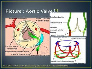 Picture reference: Anderson RH. Clinical anatomy of the aortic root. Heart. Dec 2000;84(6):670-3.

 