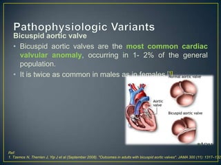 Bicuspid aortic valve
• Bicuspid aortic valves are the most common cardiac
valvular anomaly, occurring in 1- 2% of the general
population.
• It is twice as common in males as in females.[1]

Ref:
1. Tzemos N, Therrien J, Yip J et al (September 2008). "Outcomes in adults with bicuspid aortic valves". JAMA 300 (11): 1317–1325

 