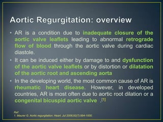 • AR is a condition due to inadequate closure of the
aortic valve leaflets leading to abnormal retrograde
flow of blood through the aortic valve during cardiac
diastole.
• It can be induced either by damage to and dysfunction
of the aortic valve leaflets or by distortion or dilatation
of the aortic root and ascending aorta
• In the developing world, the most common cause of AR is
rheumatic heart disease. However, in developed
countries, AR is most often due to aortic root dilation or a
congenital bicuspid aortic valve .[1]
Ref:
1. Maurer G. Aortic regurgitation. Heart. Jul 2006;92(7):994-1000.

 