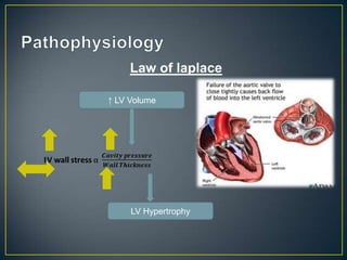Law of laplace
↑ LV Volume

LV Hypertrophy

 