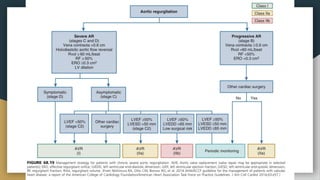 complications and management of aortic regurgitation | PPTX