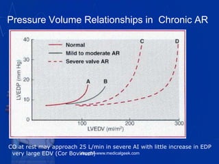 Pressure Volume Relationships in Chronic AR
CO at rest may approach 25 L/min in severe AI with little increase in EDP
very large EDV (Cor Bovinum)vitrag24-www.medicalgeek.com
 