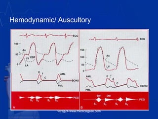 Hemodynamic/ Auscultory
vitrag24-www.medicalgeek.com
 