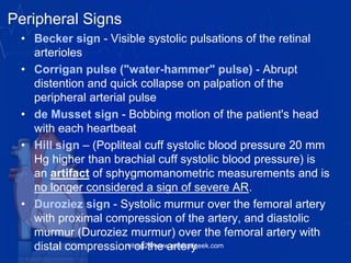 Peripheral Signs
• Becker sign - Visible systolic pulsations of the retinal
arterioles
• Corrigan pulse ("water-hammer" pulse) - Abrupt
distention and quick collapse on palpation of the
peripheral arterial pulse
• de Musset sign - Bobbing motion of the patient's head
with each heartbeat
• Hill sign – (Popliteal cuff systolic blood pressure 20 mm
Hg higher than brachial cuff systolic blood pressure) is
an artifact of sphygmomanometric measurements and is
no longer considered a sign of severe AR.
• Duroziez sign - Systolic murmur over the femoral artery
with proximal compression of the artery, and diastolic
murmur (Duroziez murmur) over the femoral artery with
distal compression of the arteryvitrag24-www.medicalgeek.com
 