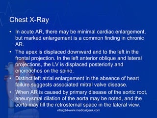 Chest X-Ray
• In acute AR, there may be minimal cardiac enlargement,
but marked enlargement is a common finding in chronic
AR.
• The apex is displaced downward and to the left in the
frontal projection. In the left anterior oblique and lateral
projections, the LV is displaced posteriorly and
encroaches on the spine.
• Distinct left atrial enlargement in the absence of heart
failure suggests associated mitral valve disease.
• When AR is caused by primary disease of the aortic root,
aneurysmal dilation of the aorta may be noted, and the
aorta may fill the retrosternal space in the lateral view.
vitrag24-www.medicalgeek.com
 
