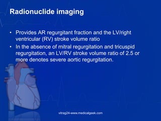 Radionuclide imaging
• Provides AR regurgitant fraction and the LV/right
ventricular (RV) stroke volume ratio
• In the absence of mitral regurgitation and tricuspid
regurgitation, an LV/RV stroke volume ratio of 2.5 or
more denotes severe aortic regurgitation.
vitrag24-www.medicalgeek.com
 