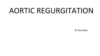 AORTIC REGURGITATION
Dr Anuradha
 