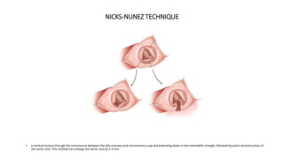 Aortic repair ppt | PPTX