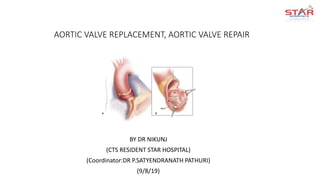AORTIC VALVE REPLACEMENT, AORTIC VALVE REPAIR
BY DR NIKUNJ
(CTS RESIDENT STAR HOSPITAL)
(Coordinator:DR P.SATYENDRANATH PATHURI)
(9/8/19)
 