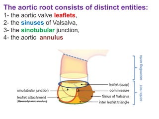 The aortic root consists of distinct entities:
1- the aortic valve leaflets,
2- the sinuses of Valsalva,
3- the sinotubular junction,
4- the aortic annulus
 
