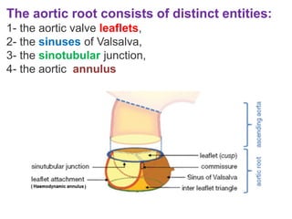 aortic root anatomy