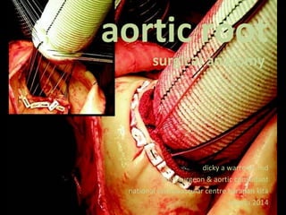 aortic root
surgical anatomy
dicky a wartono ,md
Staff surgeon & aortic consultant
national cardiovascular centre harapan kita
Jakarta 2014
 