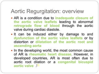 Aortic Regurgitation: overview
 AR is a condition due to inadequate closure of
the aortic valve leaflets leading to abnormal
retrograde flow of blood through the aortic
valve during cardiac diastole.
 It can be induced either by damage to and
dysfunction of the aortic valve leaflets or by
distortion or dilatation of the aortic root and
ascending aorta
 In the developing world, the most common cause
of AR is rheumatic heart disease. However, in
developed countries, AR is most often due to
aortic root dilation or a congenital bicuspid
aortic valve .[1]
 