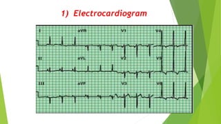 1) Electrocardiogram
 