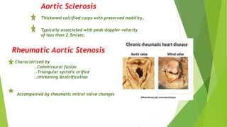 Aortic Sclerosis
Thickened calcified cusps with preserved mobility.
Typically associated with peak doppler velocity
of less than 2.5m/sec.
Rheumatic Aortic Stenosis
Characterized by
..Commissural fusion
..Triangular systolic orifice
..thickening &calcification
Accompanied by rheumatic mitral valve changes
 