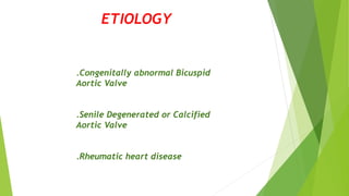 ETIOLOGY
.Congenitally abnormal Bicuspid
Aortic Valve
.Senile Degenerated or Calcified
Aortic Valve
.Rheumatic heart disease
 