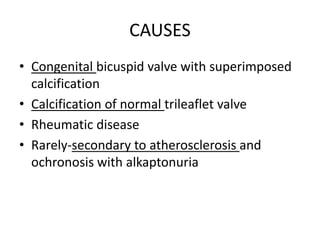 CAUSES
• Congenital bicuspid valve with superimposed
calcification
• Calcification of normal trileaflet valve
• Rheumatic disease
• Rarely-secondary to atherosclerosis and
ochronosis with alkaptonuria
 
