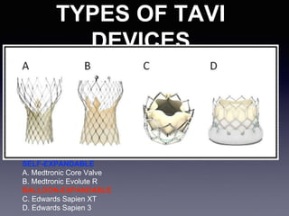 Aortic stenosis and aortic valve replasement | PPTX