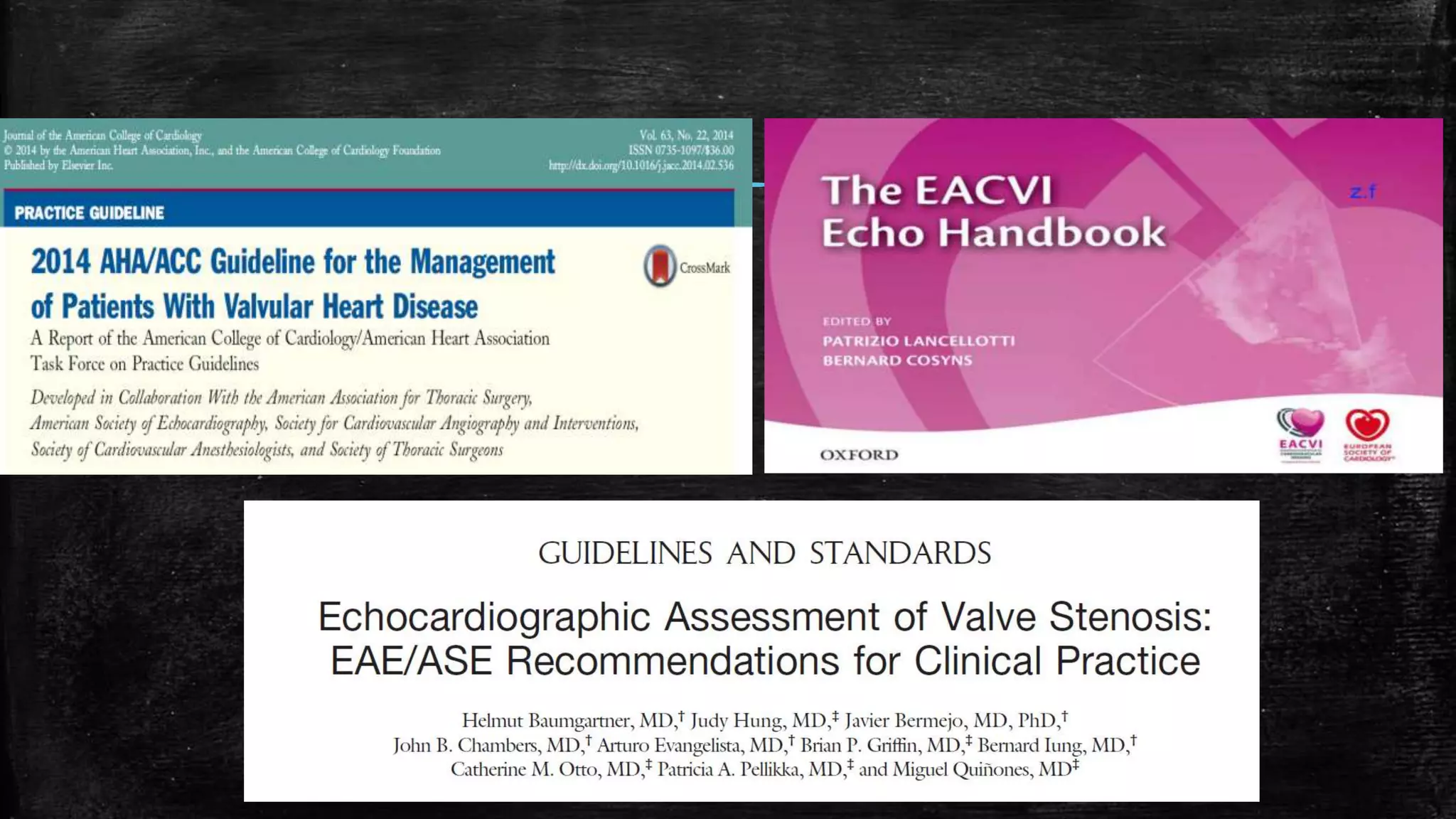 Echocardiography of Aortic stenosis | PPTX