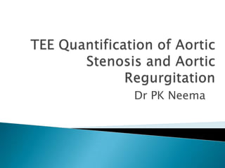 TEE Quantification of Aortic Stenosis and Aortic Regurgitation Dr PK Neema 