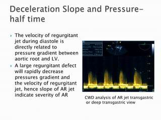 Deceleration Slope and Pressure-half timeThe velocity of regurgitant jet during diastole is directly related to pressure gradient between aortic root and LV.A large regurgitant defect will rapidly decrease pressures gradient and the velocity of regurgitant jet, hence slope of AR jet indicate severity of ARCWD analysis of AR jet transgastric or deep transgastric view