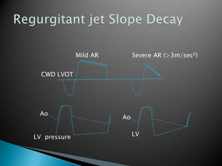 Regurgitant jet Slope DecayMild ARSevere AR (>3m/sec2)CWD LVOTAoAoLV  pressureLV