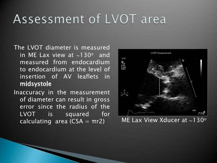 Aortic valve assessment