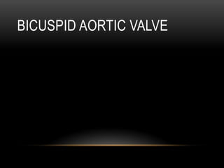 BICUSPID AORTIC VALVE
 