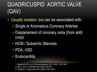 QUADRICUSPID AORTIC VALVE
(QAV)
•  Usually isolated, but can be associated with:
•  Single or Anomalous Coronary Arteries
•  Displacement of coronary ostia (from addl
cusp)
•  HCM / Subaortic Stenosis
•  PDA, VSD
•  Endocarditis
1. Jagganath AD, et al. Echocardiography 2011; 28(9), 1035-1040.
2. Zhu J, et al. J Cardiothor Surg 2013; 8(1) 87.
3. Tutarel O. J. Heart Valve Dis. 2004;13 (4): 534-7.
 