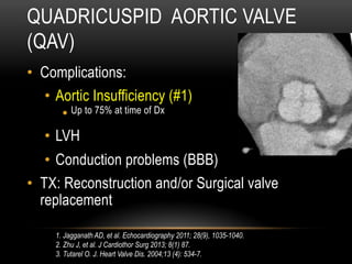 QUADRICUSPID AORTIC VALVE
(QAV)
•  Complications:
•  Aortic Insufficiency (#1)
• Up to 75% at time of Dx
•  LVH
•  Conduction problems (BBB)
•  TX: Reconstruction and/or Surgical valve
replacement
1. Jagganath AD, et al. Echocardiography 2011; 28(9), 1035-1040.
2. Zhu J, et al. J Cardiothor Surg 2013; 8(1) 87.
3. Tutarel O. J. Heart Valve Dis. 2004;13 (4): 534-7.
 