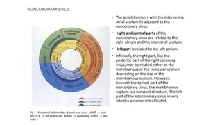 NONCORONARY SINUS
• The atrialchambers with the intervening
atrial septum lie adjacent to the
noncoronary sinus.
• right and central parts of the
noncoronary sinus are related to the
right atrium and the interatrial septum,
• left part is related to the left atrium.
• Inferiorly, the right part, like the
posterior part of the right coronary
sinus, may be related either to the
membranous or the muscular septum
depending on the size of the
membranous septum. However,
beneath the central part of the
noncoronary sinus, the membranous
septum is a constant structure. The left
part of the noncoronary sinus inserts
into the anterior mitral leaflet
 