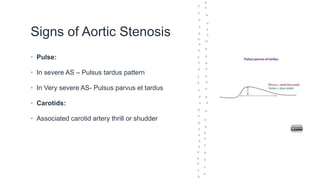 Signs of Aortic Stenosis
• Pulse:
• In severe AS – Pulsus tardus pattern
• In Very severe AS- Pulsus parvus et tardus
• Carotids:
• Associated carotid artery thrill or shudder
 