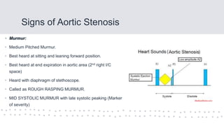 Signs of Aortic Stenosis
• Murmur:
• Medium Pitched Murmur.
• Best heard at sitting and leaning forward position.
• Best heard at end expiration in aortic area (2nd right I/C
space)
• Heard with diaphragm of stethoscope.
• Called as ROUGH RASPING MURMUR.
• MID SYSTOLIC MURMUR with late systolic peaking (Marker
of severity)
 