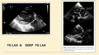 TG LAX & DEEP TG LAX
 