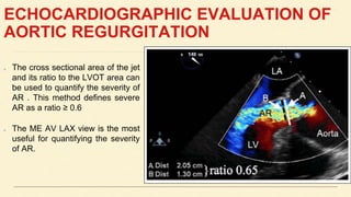 ECHOCARDIOGRAPHIC EVALUATION OF
AORTIC REGURGITATION
The cross sectional area of the jet
and its ratio to the LVOT area can
be used to quantify the severity of
AR . This method defines severe
AR as a ratio ≥ 0.6
The ME AV LAX view is the most
useful for quantifying the severity
of AR.
 