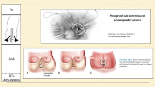 Aortic valve Repair & Replacement.TEEpptx