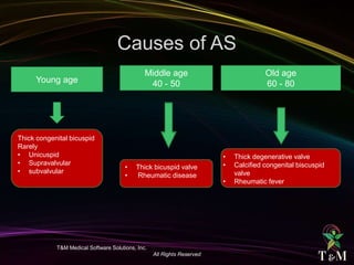 T&M Medical Software Solutions, Inc.
All Rights Reserved
Young age
Middle age
40 - 50
Thick congenital bicuspid
Rarely
• Unicuspid
• Supravalvular
• subvalvular
• Thick degenerative valve
• Calcified congenital biscuspid
valve
• Rheumatic fever
Old age
60 - 80
• Thick bicuspid valve
• Rheumatic disease
 
