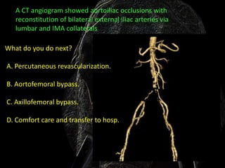 A CT angiogram showed aortoiliac occlusions with
   reconstitution of bilateral external iliac arteries via
   lumbar and IMA collaterals

What do you do next?

A. Percutaneous revascularization.

B. Aortofemoral bypass.

C. Axillofemoral bypass.

D. Comfort care and transfer to hosp.
 