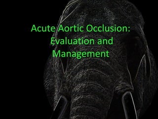 Acute Aortic Occlusion:
    Evaluation and
    Management
 